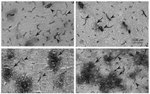 ICAM-1 Antibody in Immunohistochemistry (IHC)