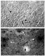 ICAM-1 Antibody in Immunohistochemistry (IHC)