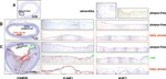 ICAM-1 Antibody in Immunohistochemistry (IHC)