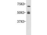 Complement C3 (beta chain) Antibody in Western Blot (WB)