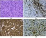 MDM2 Antibody in Immunohistochemistry (IHC)