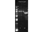 Plasminogen Antibody in Western Blot (WB)