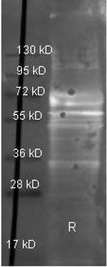 Fibrinogen Antibody in Western Blot (WB)