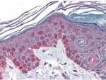 Cyclin T1 Antibody in Immunohistochemistry (Paraffin) (IHC (P))