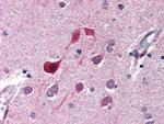 CDK5 Antibody in Immunohistochemistry (Paraffin) (IHC (P))