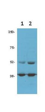 CDK9 Antibody in Western Blot (WB)