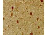 p130 Rb2 Antibody in Immunohistochemistry (Paraffin) (IHC (P))