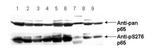 Phospho-NFkB (RelA) (Ser276) Antibody in Western Blot (WB)