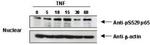 Phospho-NFkB (RelA) (Ser276) Antibody in Western Blot (WB)