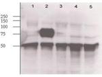 Angiopoietin 2 Antibody in Western Blot (WB)