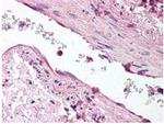 Angiopoietin 1 Antibody in Immunohistochemistry (Paraffin) (IHC (P))