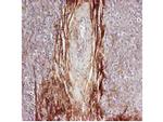 Osteopontin Antibody in Immunohistochemistry (IHC)