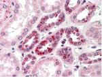 NOTCH 2 Antibody in Immunohistochemistry (Paraffin) (IHC (P))