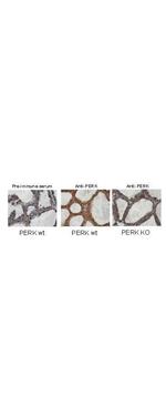 PERK Antibody in Immunohistochemistry (IHC)