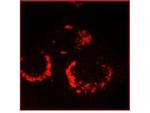 Sars-Cov Nonstructural Protein 13 Antibody in Immunocytochemistry (ICC/IF)