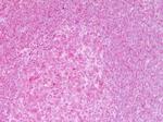 NFkB p65 Antibody in Immunohistochemistry (Paraffin) (IHC (P))