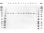 NFkB p65 Antibody in Western Blot (WB)