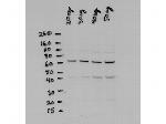 NFkB p65 Antibody in Western Blot (WB)