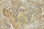 Marcks Antibody in Immunohistochemistry (Paraffin) (IHC (P))