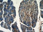 Marcks Antibody in Immunohistochemistry (Paraffin) (IHC (P))