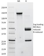 P-Cadherin (CDH3) Antibody in SDS-PAGE (SDS-PAGE)