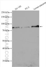 5 Lipoxygenase Antibody in Western Blot (WB)