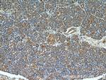 cIAP1 Antibody in Immunohistochemistry (Paraffin) (IHC (P))