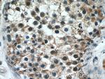 cIAP1 Antibody in Immunohistochemistry (Paraffin) (IHC (P))