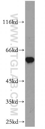 cIAP1 Antibody in Western Blot (WB)