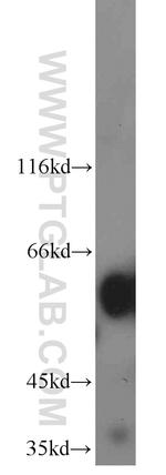 cIAP1 Antibody in Western Blot (WB)