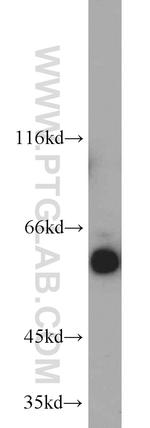 cIAP1 Antibody in Western Blot (WB)