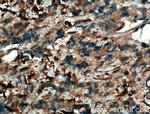 JNK Antibody in Immunohistochemistry (Paraffin) (IHC (P))