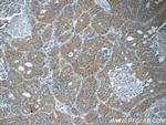 JNK Antibody in Immunohistochemistry (Paraffin) (IHC (P))