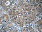 JNK Antibody in Immunohistochemistry (Paraffin) (IHC (P))