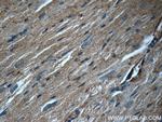 JNK Antibody in Immunohistochemistry (Paraffin) (IHC (P))