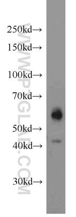 JNK Antibody in Western Blot (WB)