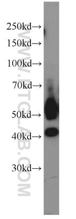 JNK Antibody in Western Blot (WB)