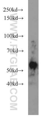 JNK Antibody in Western Blot (WB)