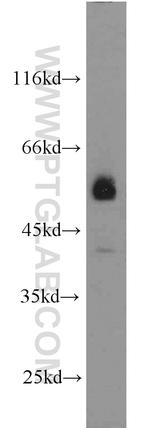 JNK Antibody in Western Blot (WB)