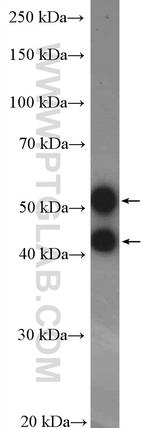 JNK Antibody in Western Blot (WB)