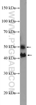 JNK Antibody in Western Blot (WB)