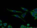 JNK Antibody in Immunocytochemistry (ICC/IF)