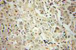 JNK Antibody in Immunohistochemistry (Paraffin) (IHC (P))