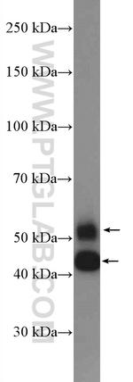 JNK Antibody in Western Blot (WB)