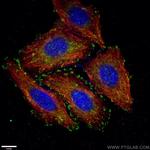 Paxillin Antibody in Immunocytochemistry (ICC/IF)