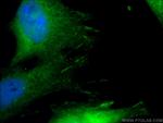 Paxillin Antibody in Immunocytochemistry (ICC/IF)