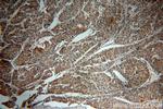 Paxillin Antibody in Immunohistochemistry (Paraffin) (IHC (P))