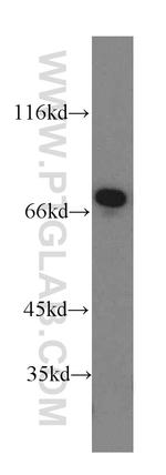 Paxillin Antibody in Western Blot (WB)