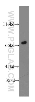 Paxillin Antibody in Western Blot (WB)
