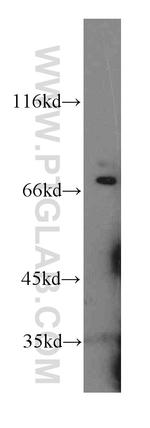 Paxillin Antibody in Western Blot (WB)